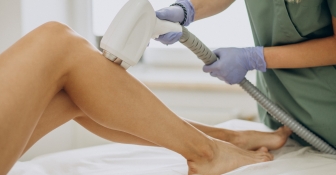 La tendencia creciente de la depilación láser y sus beneficios